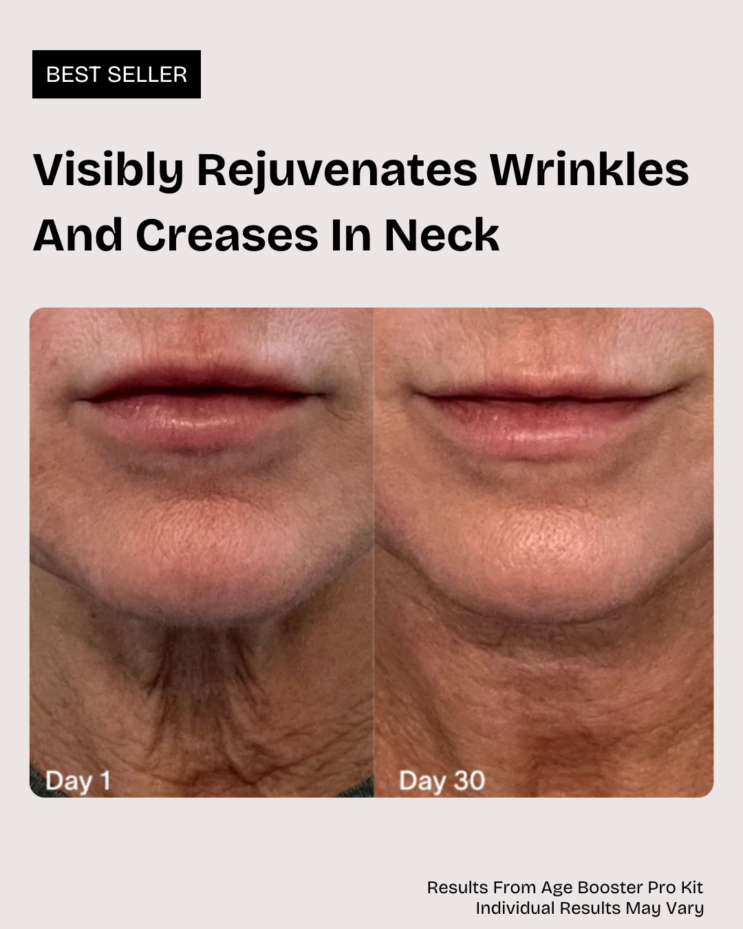 Age-Booster Pro Kit